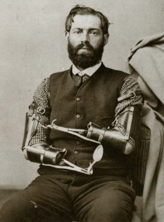 Illustration for article titled The History of Prosthetics Reveals a Long Tradition of Human Cyborgs